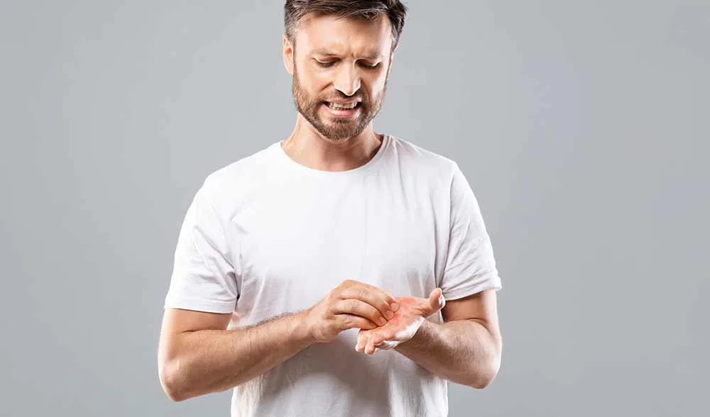 man with itchy left palm and hand