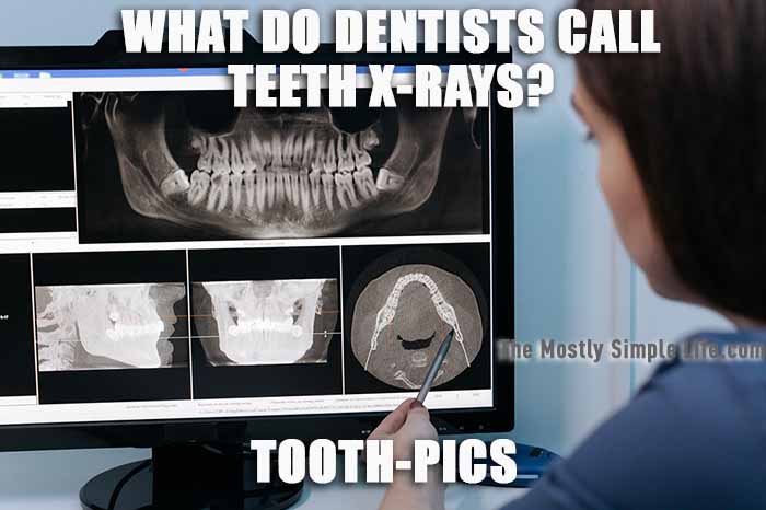 teeth xray joke